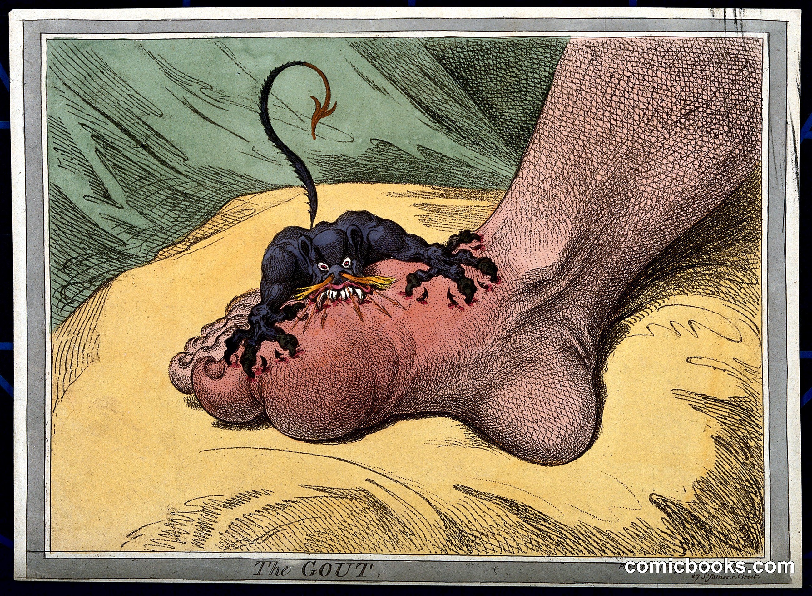 The Gout