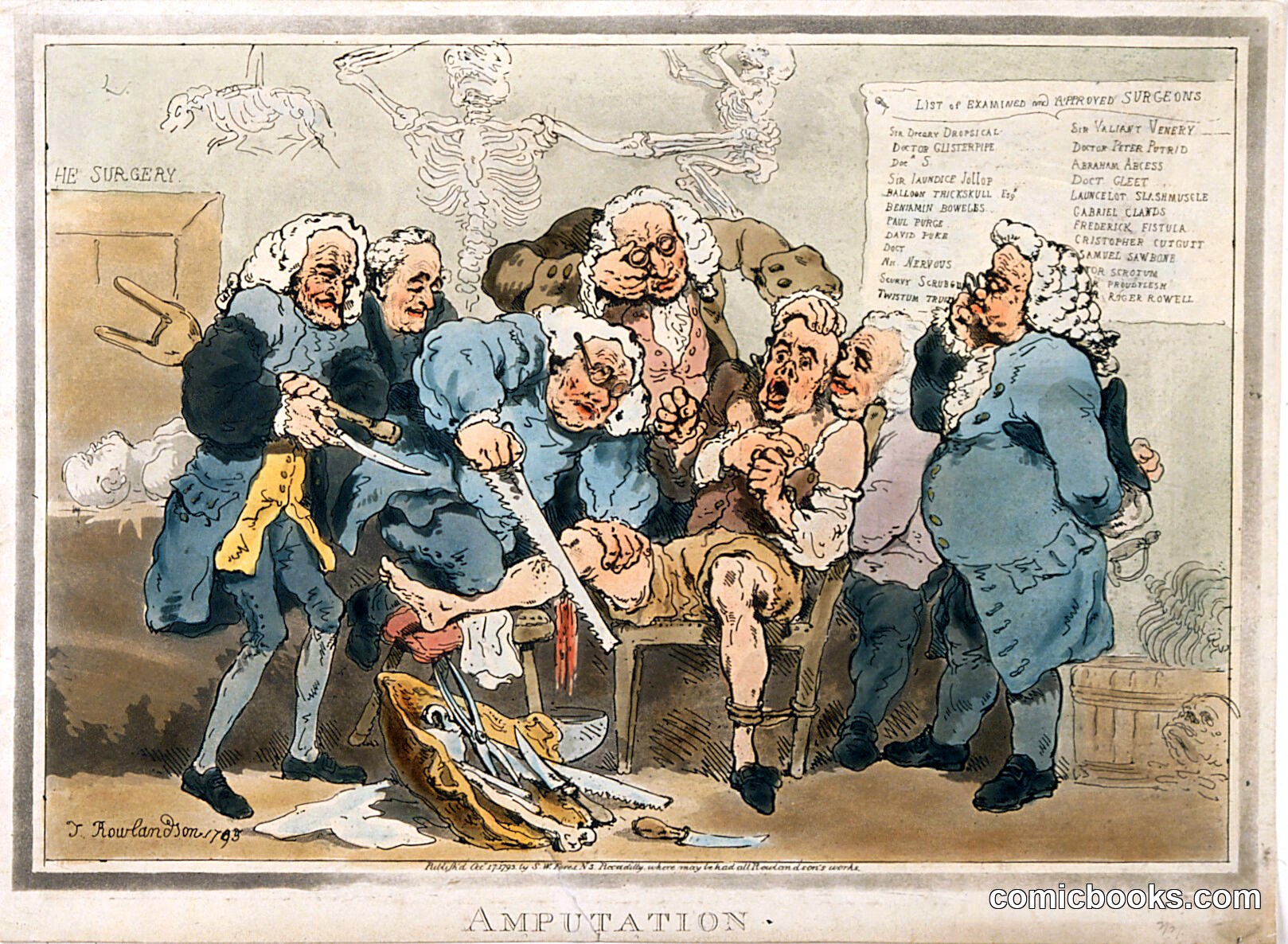 Five Surgeons Performing an Amputation